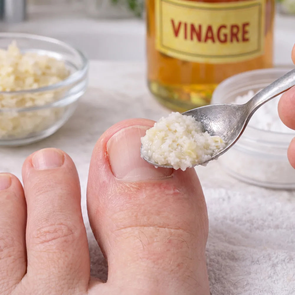 Receitas caseiras
